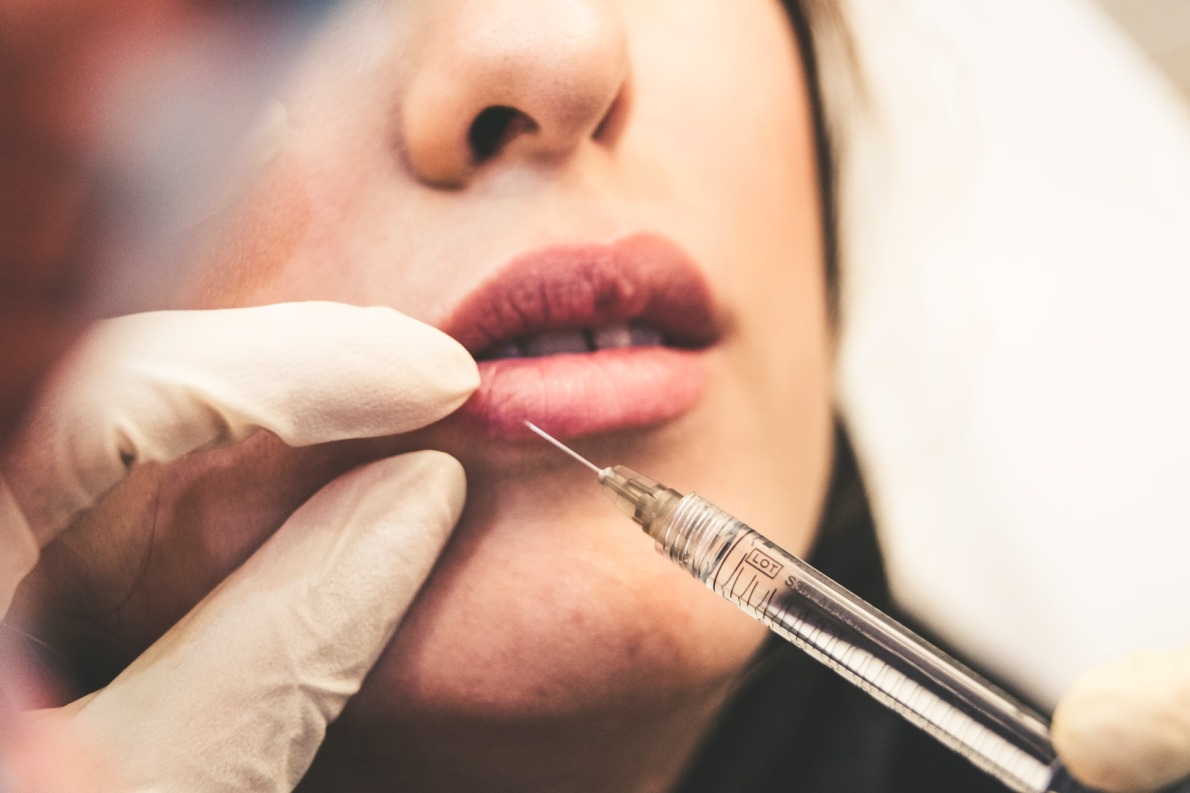 médecine esthetique acide