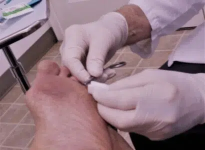 Sutures! Stitches! Dermatologist! Healthcare and Medicine!