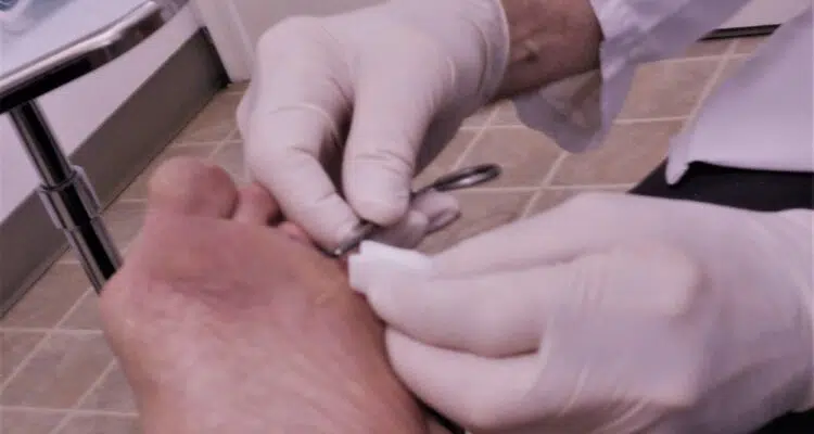 Sutures! Stitches! Dermatologist! Healthcare and Medicine!