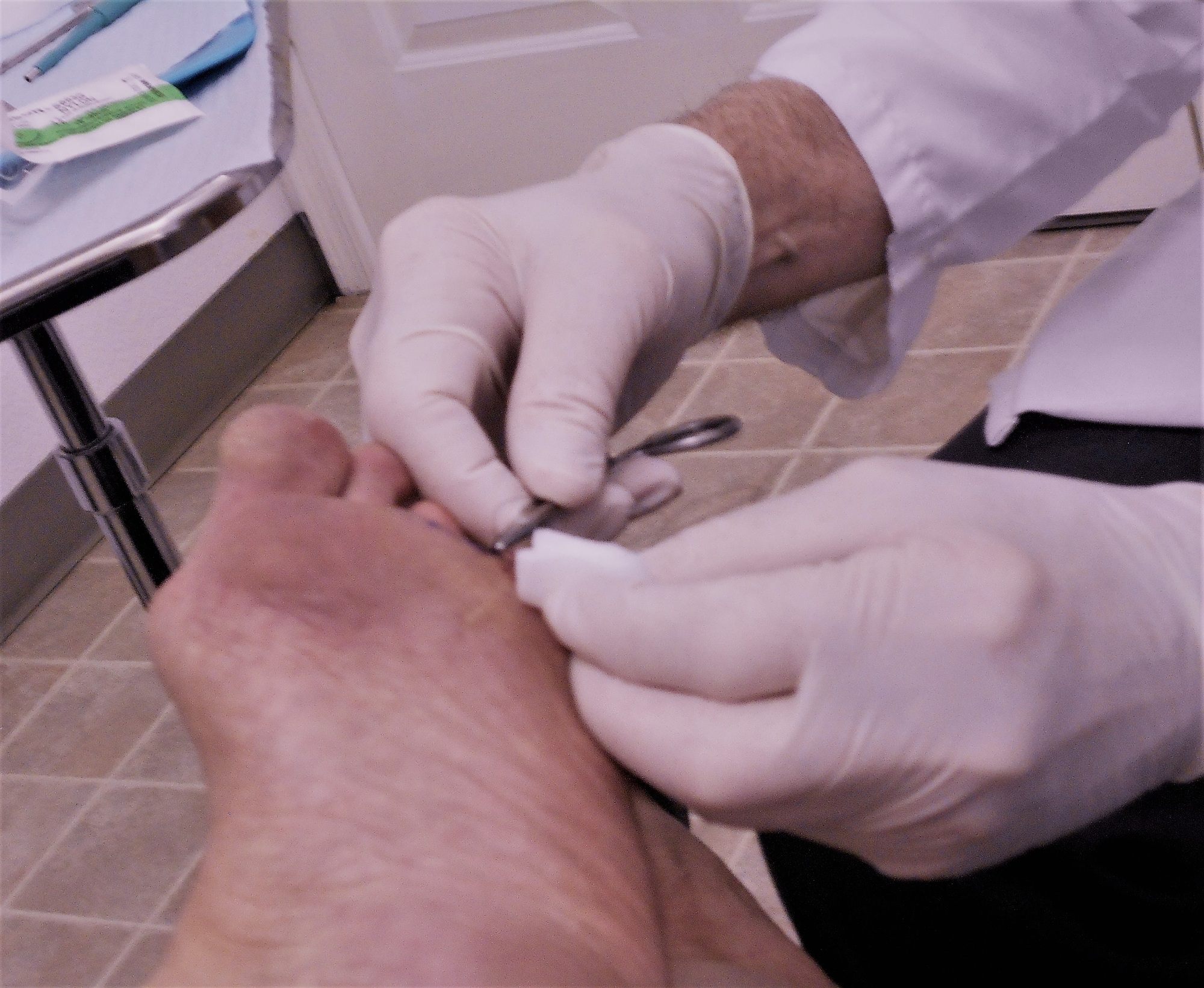 Sutures! Stitches! Dermatologist! Healthcare and Medicine!